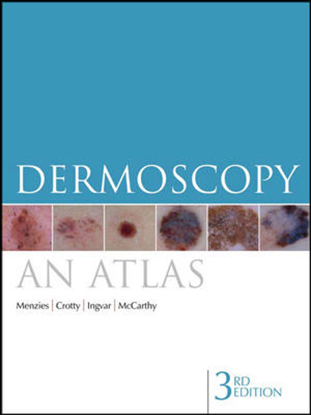 Picture of Dermoscopy: An Atlas (3rd Edition)