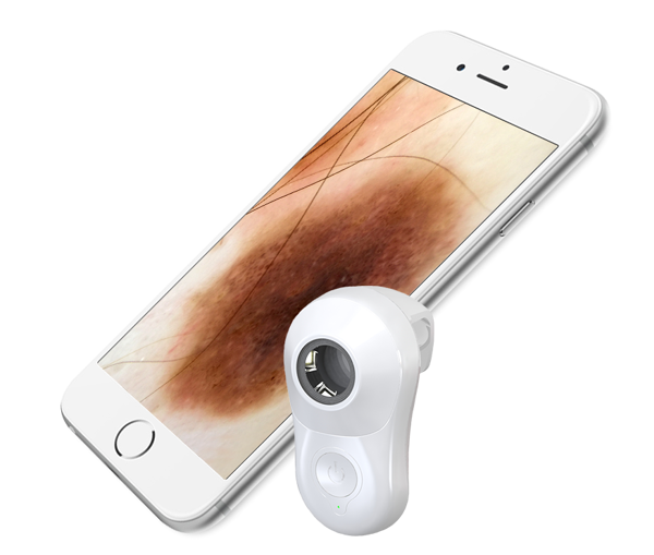 Picture of Dermatoscope Molescope II For iPod Touch 5/6